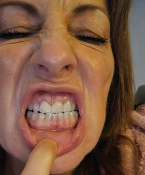 files/Teeth_Pic_16.webp