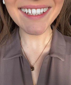 files/Teeth_Pic_18.webp