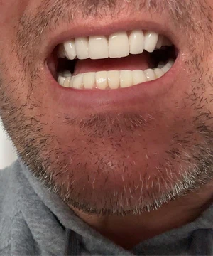 files/Teeth_Pic_6.webp